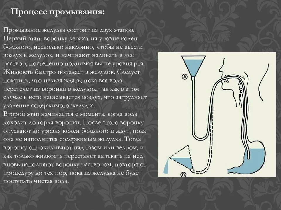 Промывание через зонд. Промывание желудка. Пропромывание желудка. Зонд для промывания желудка. Способы промывания желудка.