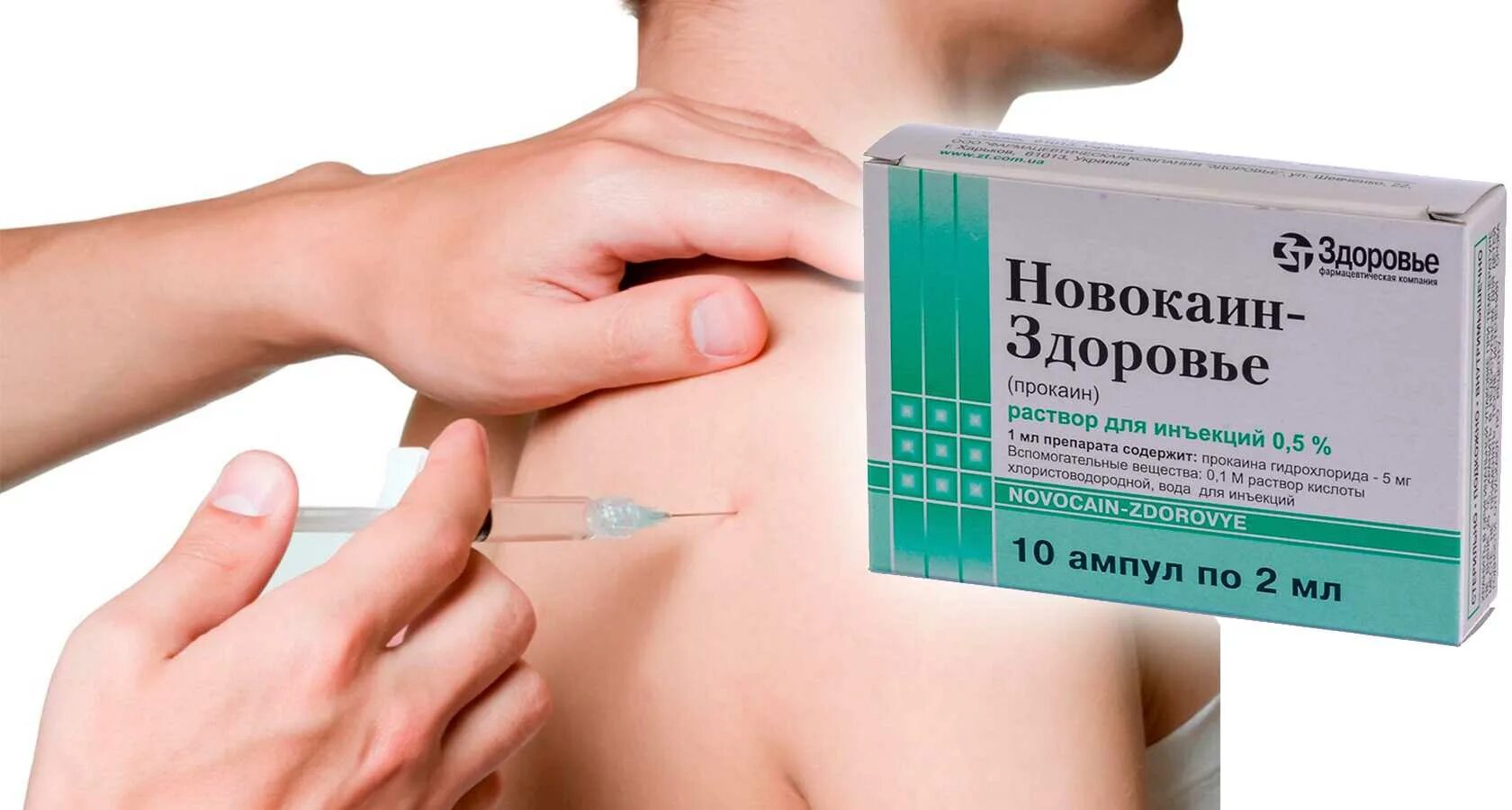 Делают ли блокаду