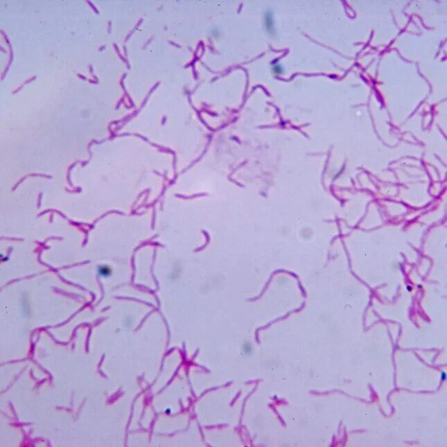 Sneathia spp