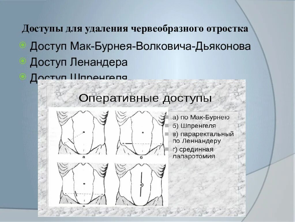 Положение при аппендиците. Мак Бурнея Волковича Дьяконова. Доступ Волковича Мак Бурнея. Оперативный доступ - Волковича- Дьяконова. Операция Мак Бурнея Волковича.