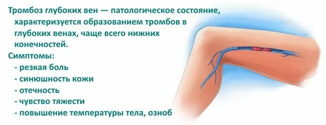 Исследование крови на тромбы. Анализ на тромбоз. Анализ крови на тромбоз. Тромбофлебит показатели крови. Тромбоз кровотечение