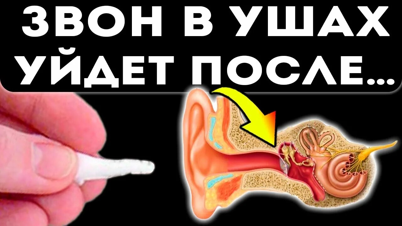 Жужжание в ухе. Звон в ушах. Шум звон в ушах причины. Звони ушах. Шум в ушах звенит.