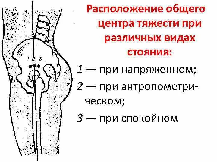 Где расположен центр тяжести тела при неустойчивом
