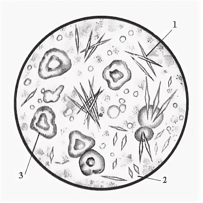Микроскопия желчи. Элементы микроскопии желудочного сока. Кристаллы жирных кислот микроскопия кала. Исследование желудочного содержимого клиническое значение. Нейтрофилы в ликворе клетки.