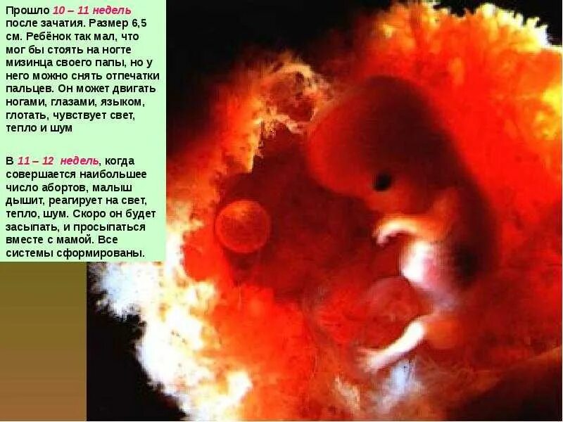 Можно все 3 неделя. Зародыш 2-3 недели беременности от зачатия. Эмбрион 4 недели беременности зачатия. Эмбрион на 4 неделе после зачатия.