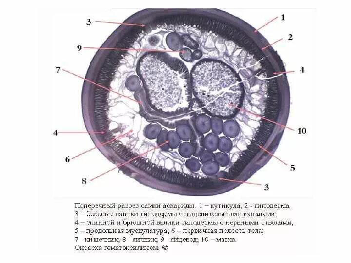 Срез червя под микроскопом. Препарат: поперечный срез ascaris lumbricoides. поперечный срез самки ascaris lumbricoides. поперечный срез аскариды препарат. поперечный срез тела самки аскариды человеческой.