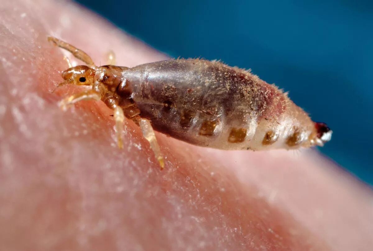 Вошь головная как избавиться. Платяная вошь (pediculus humanus corporis).