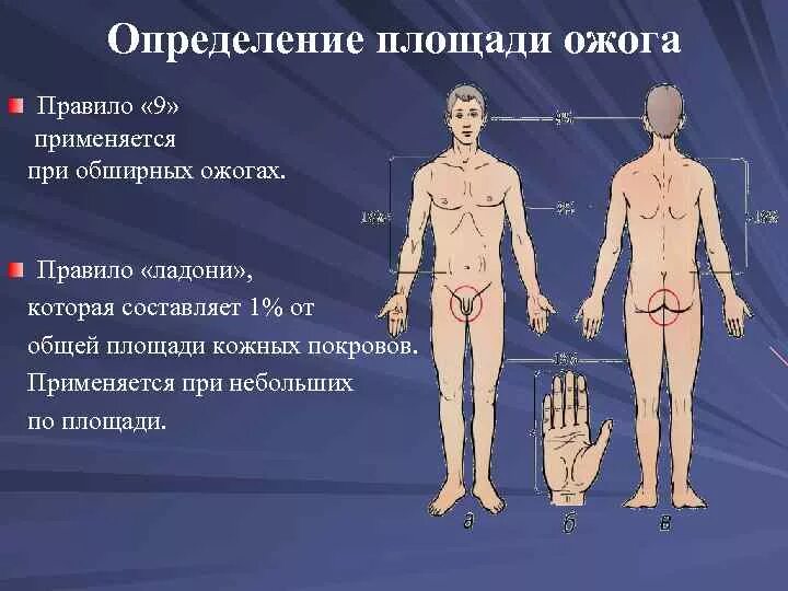 Расчет площади поражения ожога. Определить примерно процент ожогового поражения тела человека. Определить примерно процент ожогового поражения тела человека. Подсчет площади ожоговой поверхности. Определить примерно процент ожогового поражения тела человека.