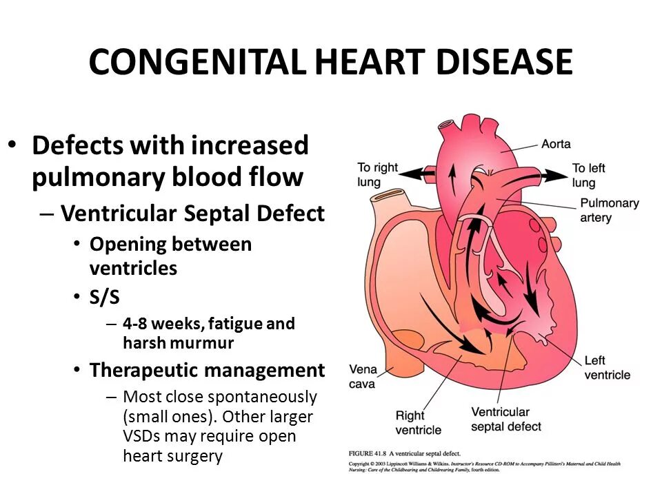 Congenital heart disease. Congenital heart disease classification. Congenital heart disease manual for doctors krivoshchekov cover book. Congenital heart disease. Congenital heart disease.