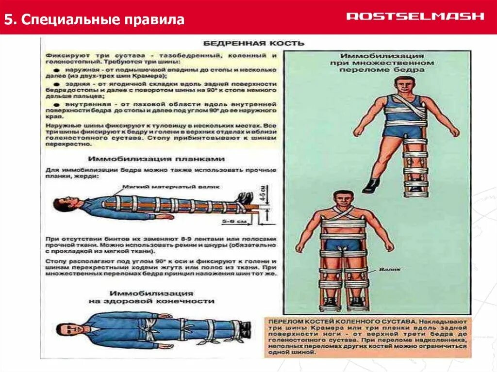 Первая помощь при переломе шейки. Оказание первой помощи при переломе бедренной кости. оказание первой помощи при закрытом переломе бедра. оказание первой помощи при закрытом переломе бедренной кости. оказание первой помощи при открытом переломе бедра.