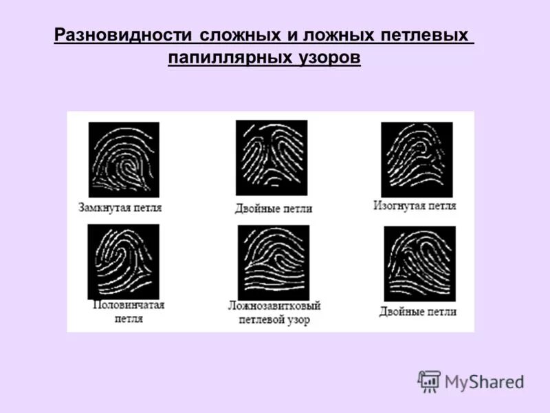 типы узоров папиллярных линий. детали строения папиллярных линий. флексорные линии в криминалистике. классификация следов папиллярных узоров криминалистика. трасологически важными свойствами папиллярных линий человека являются.