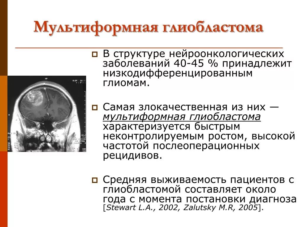 Прогноз после операции головного мозга. Опухоль головного мозга глиобластома 4. мультиформная глиобластом. мультиформенная глиобластома. характеристика глиобластомы.