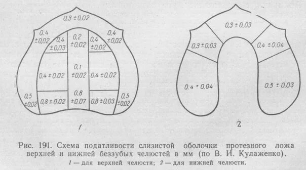 Зона податливости слизистой оболочки по Гаврилову. Зоны податливости слизистой оболочки по Люнду. Податливость слизистой оболочки протезного ложа. Классификация слизистой оболочки по Гаврилову. Люнд слизистой оболочки