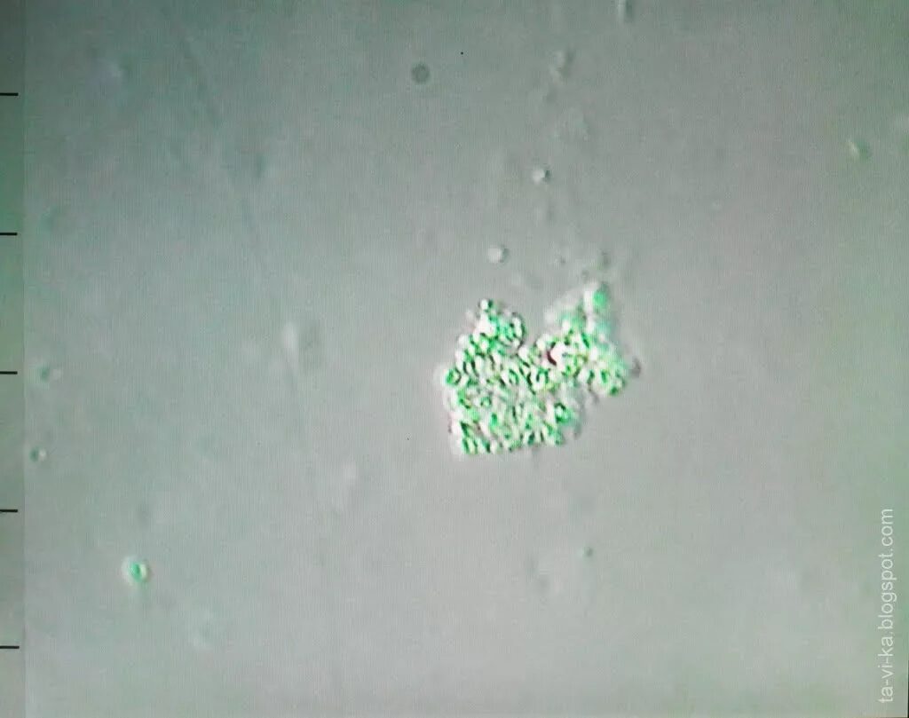 Слюни под микроскопом. Бактерии в слюне под микроскопом. Слюна человека под микроскопом. Ротовая жидкость под микроскопом. Бактерии в слюне