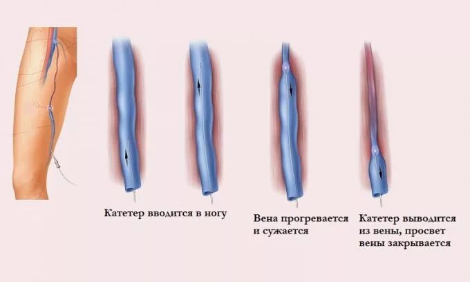 Через сколько вскрывается