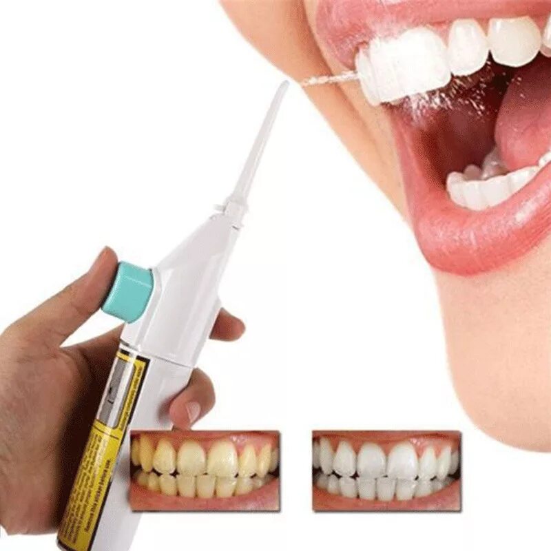 Комплексная гигиена полости рта. Ирригатор для полости рта Dental Spa. Ирригатор Tooth Cleaner. Ирригатор Дентал Ier 315p.