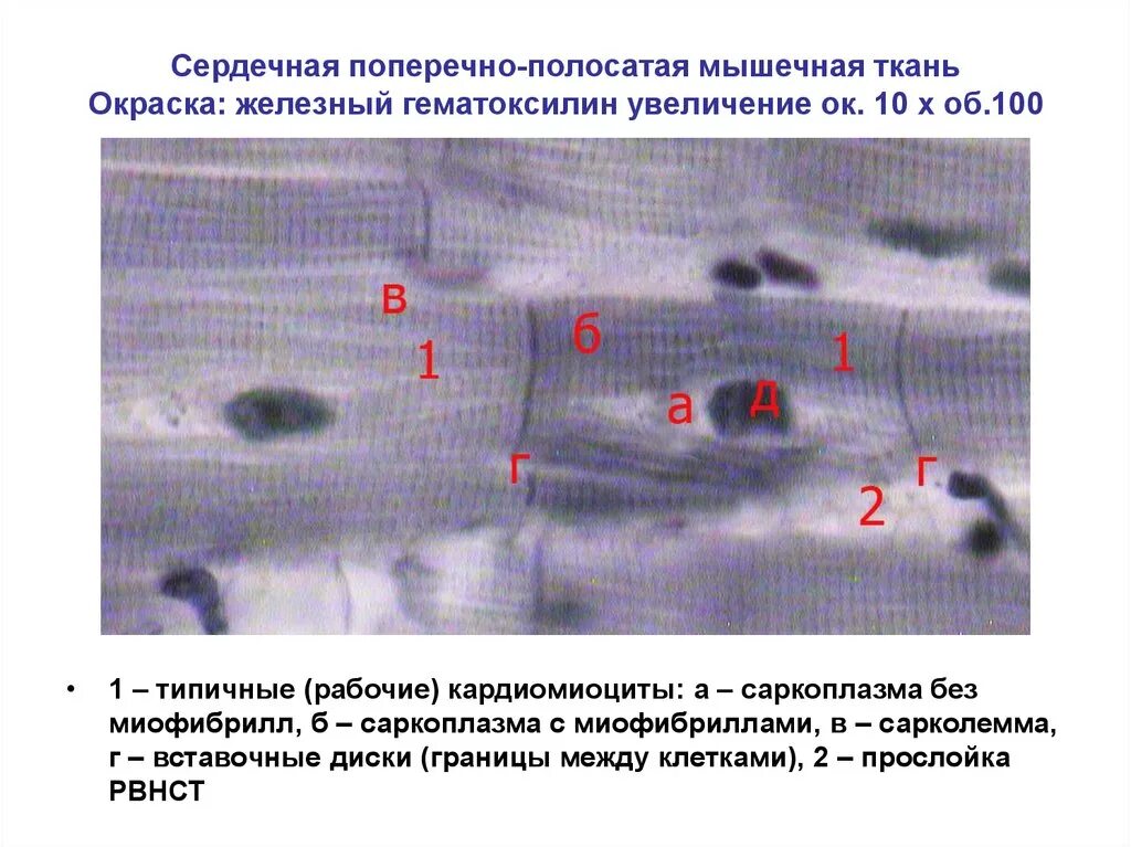 Сердечная мышечная ткань окраска Железный гематоксилин. Сердечная мышечная ткань препарат окраска Железный гематоксилин. Сердечная мышечная ткань гистология окраска железным гематоксилином. Препарат сердечная мышечная ткань Железный гематоксилин. Препарат поперечно полосатая мышечная ткань