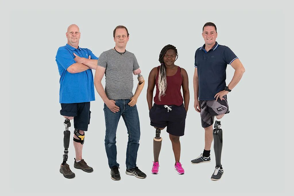 Группы инвалидности при ампутации. Средства протезной техники для занятий бегом.