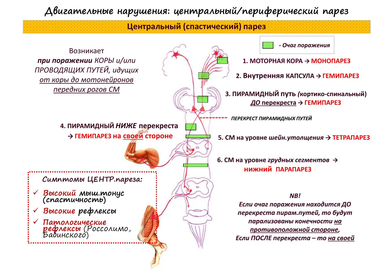 Симптомы периферического паралича неврология. Нижний Центральный парапарез возникает при поражении. Центральный парапарез нижних конечностей локализация поражения. Периферический тетрапарез очаг поражения. Этапируются это