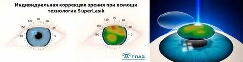 Сколько длится лазерная коррекция
