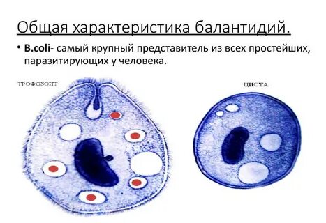 Балантидий