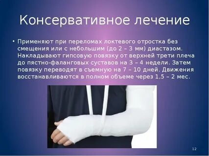 Накладывают ли гипс при растяжении связок