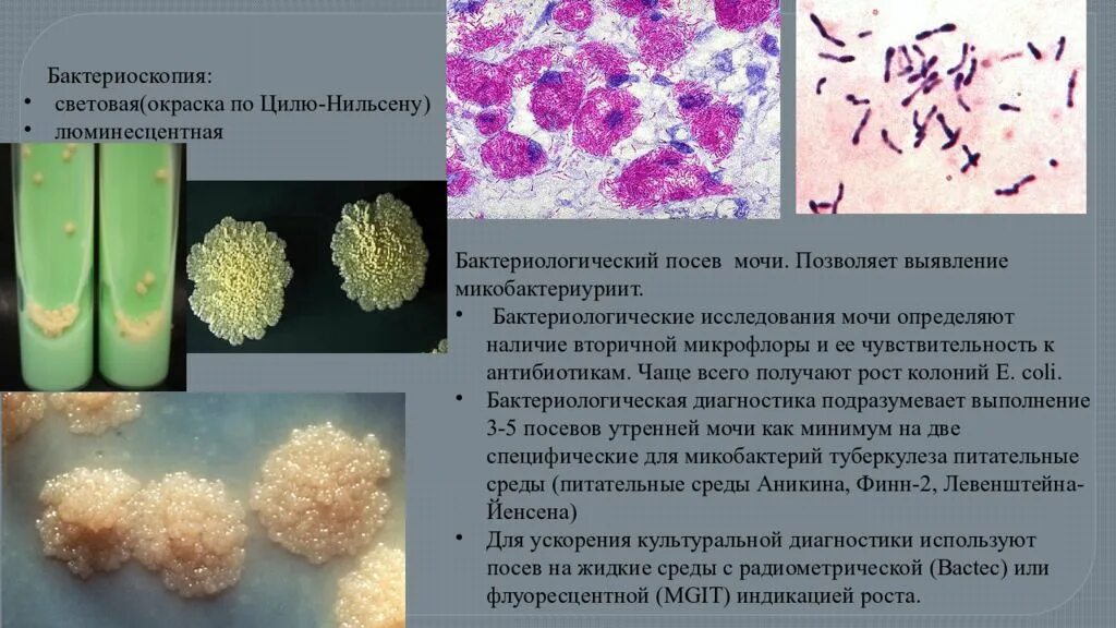 Бактериоскопия
