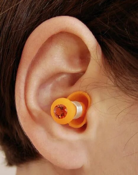 Отомикоз серная пробка. Ear wax. Ear wax. Отомикоз серная пробка. Earwax removal.