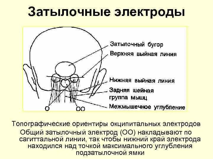 Зрительные ядра таламуса. Промежуточный мозг отделы и функции. Левый зрительный бугор. Нижняя височная линия. Затылочный бугор человека где находится.