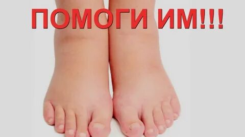 Пятка психосоматика