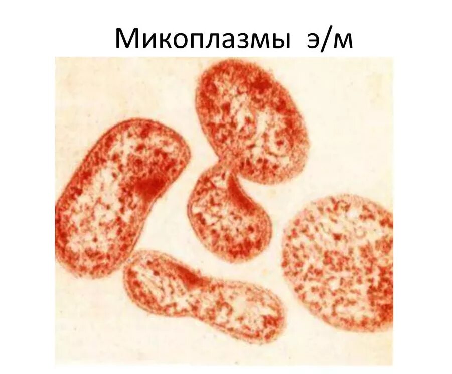 Chlamydia trachomatis mycoplasma genitalium. Микоплазмы микробиология морфология. Микоплазмы препарат микробиология. Микоплазмы под микроскопом микробиология. Микоплазмы препарат рисунок.