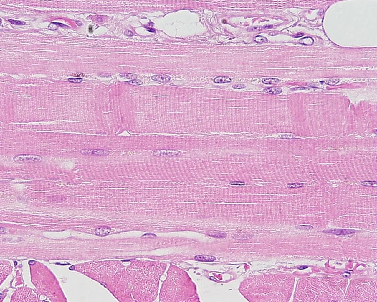 Миоциты гистология. Мышечная ткань гистология препараты. Скелетная мышечная ткань гистология препарат. Поперечнополосатая мышечная ткань гистология. Препарат поперечно полосатая мышечная ткань