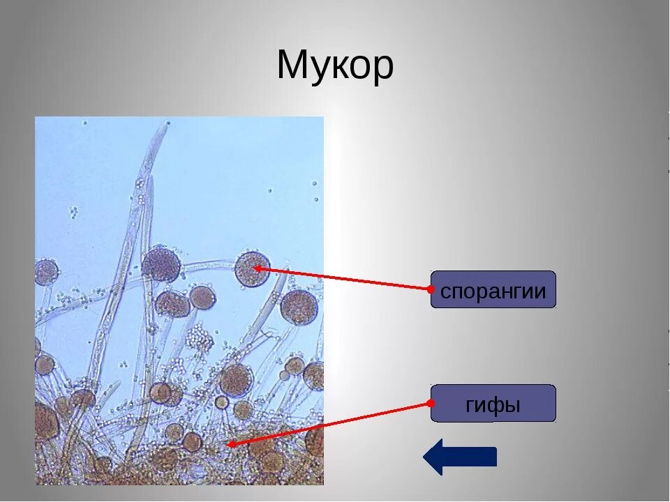 Споры гриба мукора. Гриб мукор под микроскопом. Плесень мукор под микроскопом строение. Плесень мукор под микроскопом. Гриб мукор строение под микроскопом.