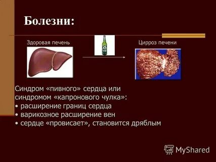 Анализы здоровая печень