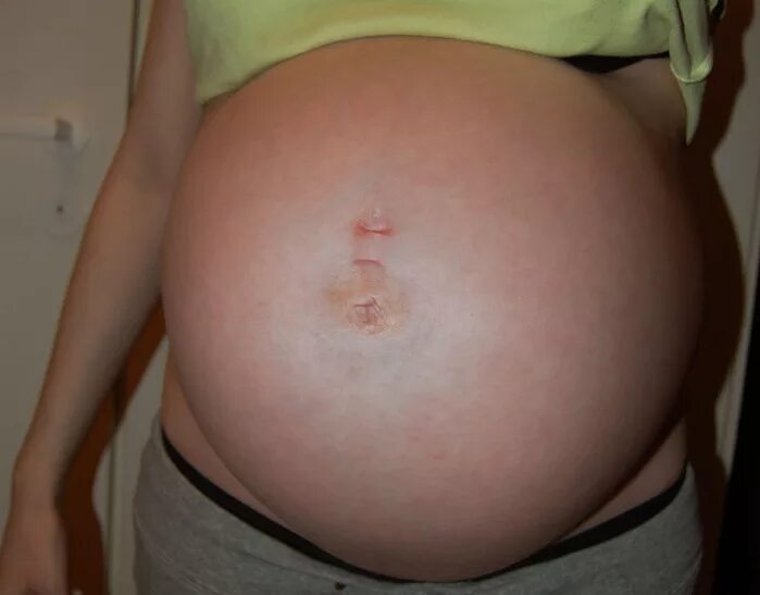 Пуп 3. Животы беременных мальчиками. Форма живота беременной мальчиком. Форма живота беременной мальчиком и девочкой.