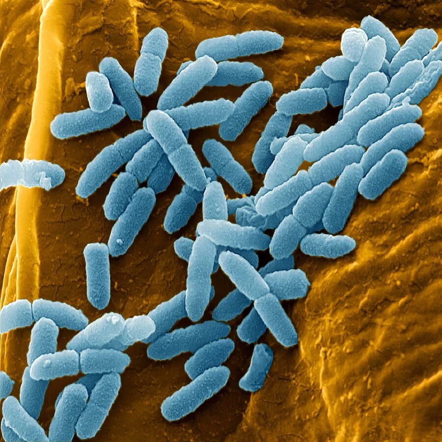 Болезнетворная бактерия палочка. Псевдомонада aeruginosa. Бактерия Pseudomonas aeruginosa. Бактерия синегнойная палочка. Синегнойная палочка биопленка.