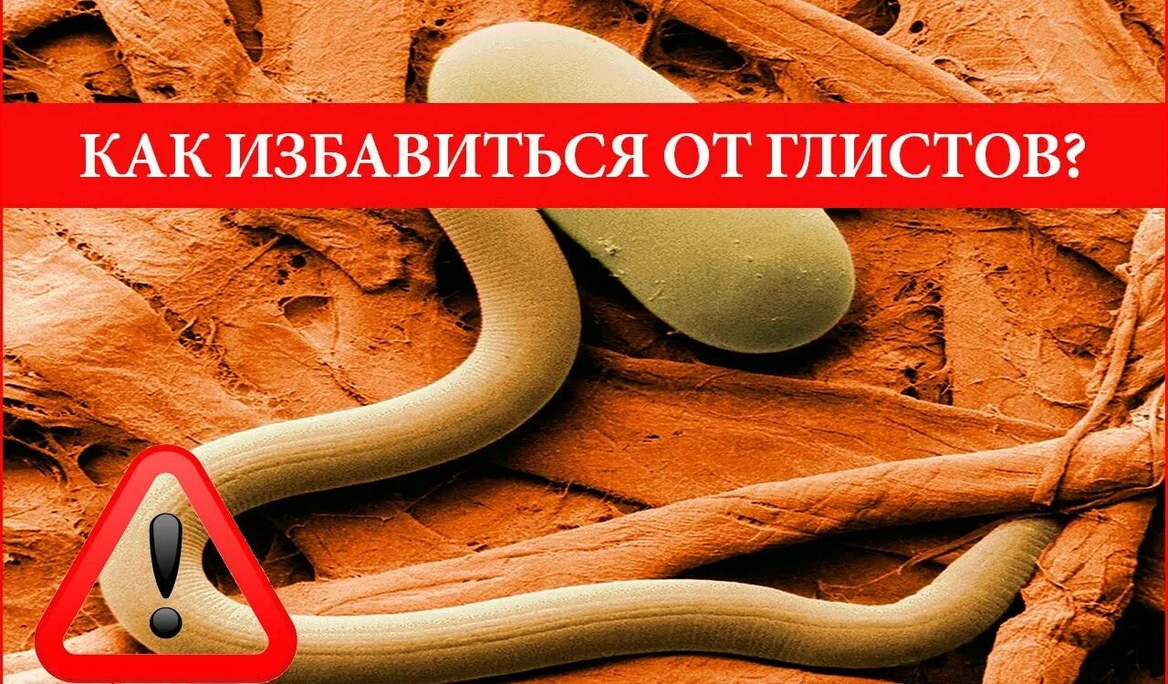 Как избавиться от глистов без лекарств. Избавиться от гельминтов. как избавиться от глистов.