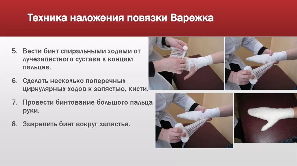 Техника наложения варежки