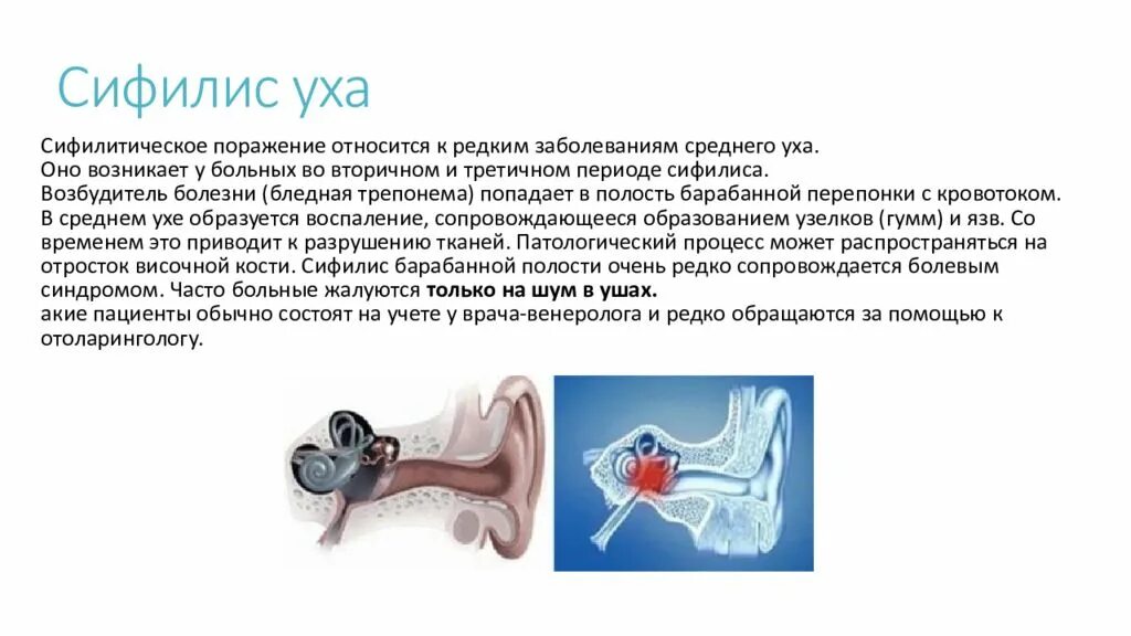 Нарушения среднего уха. Заболевания среднего уха. заболевания среднего уха презентация. патологии среднего уха.