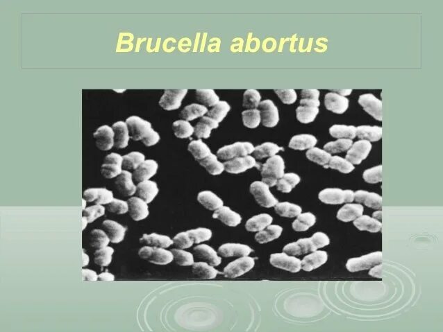 Brucella spp. Бруцелла бактерия. brucella melitensis морфология. brucella abortus микроскопия. brucella abortus морфология.