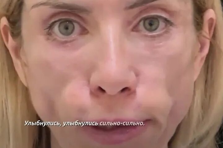 Юля после пластики