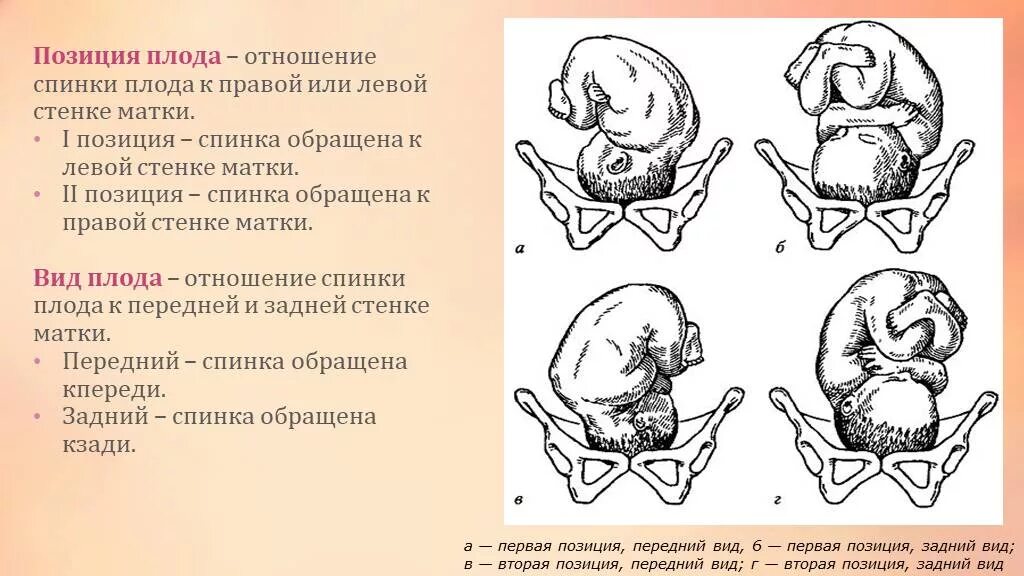 Позиция плода в акушерстве