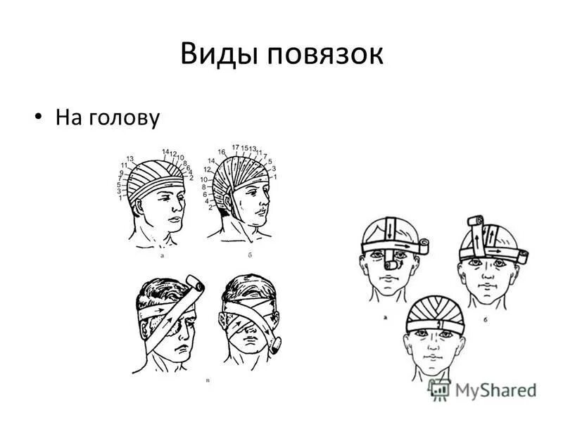 Основные типы бинтовых повязок. Виды повязок. Наложение основных видов мягких повязок. Типы повязок. Повязки медицинские названия.