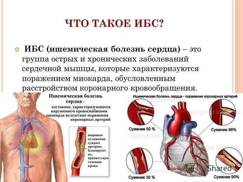 Вылечить ишемию. Ишемическая болезнь сердца (ИБС). Клинические проявления ишемической болезни сердца. Ишемическая болезнь сердца поражение миокарда. Проявления ишемической болезни сердца хронической и острой.