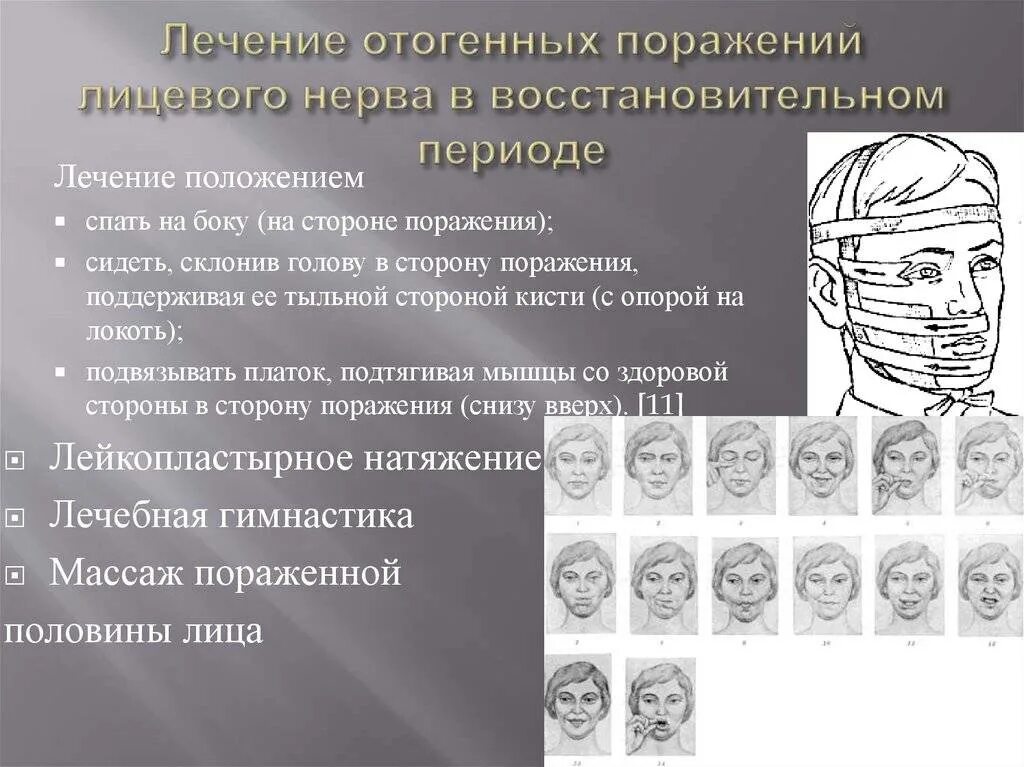 Неврит лицевого нерва схема. Лечебная физкультура при невралгии лицевого нерва. невропатия (неврит) лицевого нерва.. упражнения при неврите тройничного нерва.