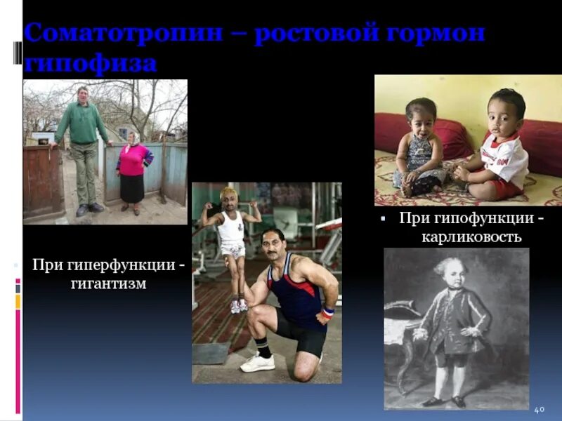 Болезнь гормона роста. Соматотропин гормон роста. Гиперфункция соматотропина. Недостаток гормона роста. Соматотропный гормон гипофункция.