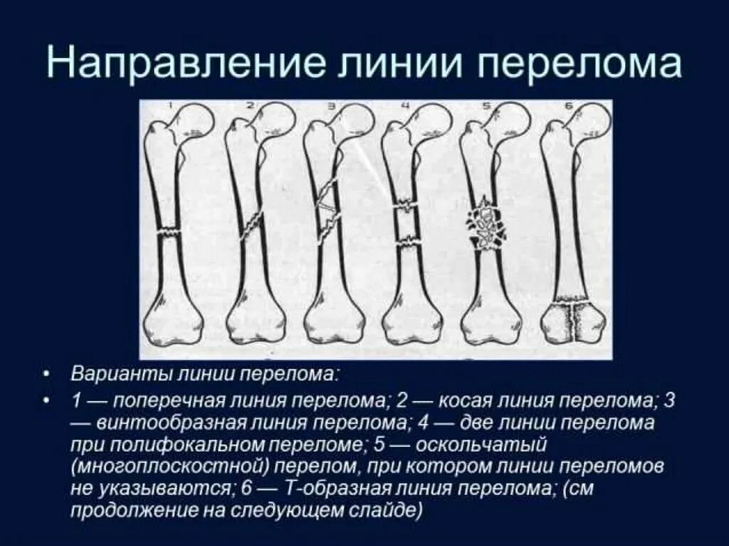 Изменения костной структуры