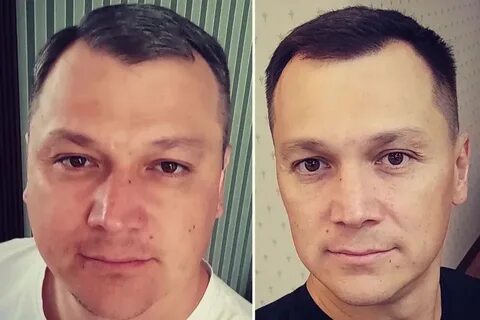 Лицо без отказа