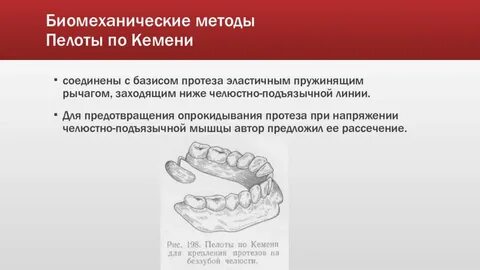 Механический метод фиксации протезов