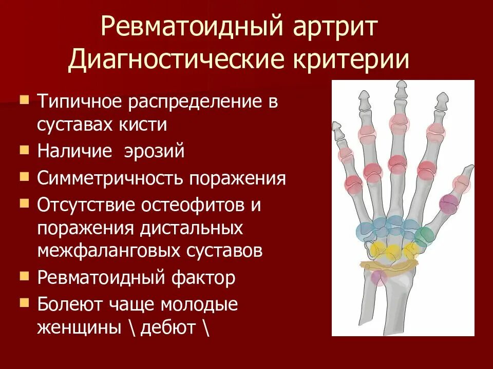 Ревматоидный фактор лечение. Ревматоидный артрит симметричное поражение суставов. Ревматоидный артрит суставов кисти. Ревматоидный артрит суставы дистальные. Ревматоидный артрит межфаланговые.